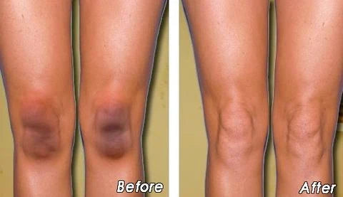 Face & Body Oil Spot Correcting & Brightening Hypoallergenic