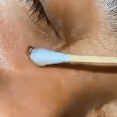 Serum Turmeric Brightening Dark Spot Correcting
