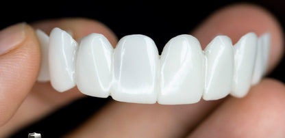 Snap-On Cosmetic Teeth Veneers for Covering Gaps, Stains & Missing Teeth – Reusable Smile Enhancement for Daily Confidence & Special Events