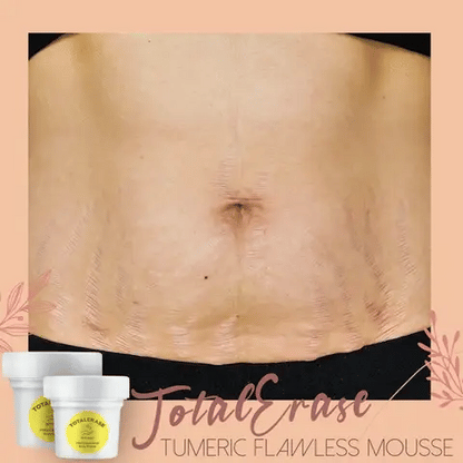 Body Mousse Reduces Stretch Marks Turmeric & Argan Oil