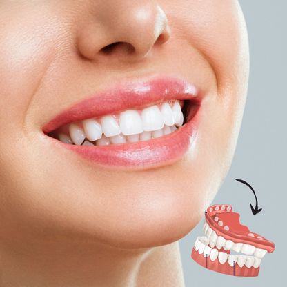 Removable Cosmetic Teeth Veneers for Adults – Instant Smile Enhancer with Silicone Liner, Reusable Snap-On Dental Cover for Natural Look