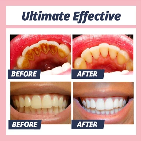 Toothpaste Baking Soda Whitening Fluoride-Free