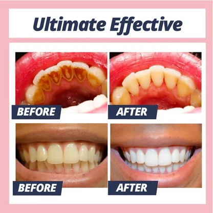 Toothpaste Baking Soda Whitening Fluoride-Free