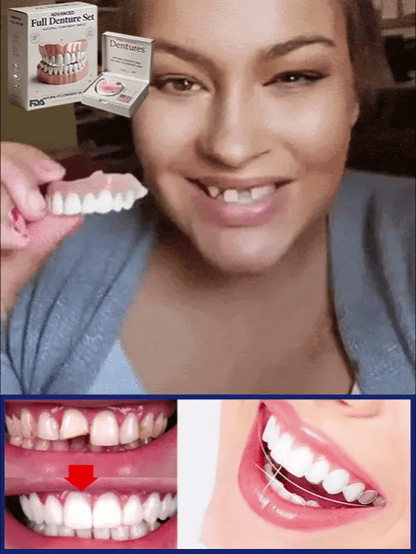 Moldable Cosmetic Denture Set Upper & Lower – Heat-Fit Natural White Teeth for Everyday Confidence
