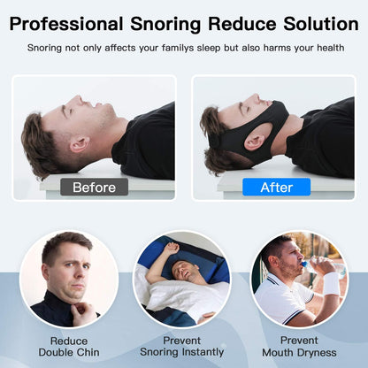 Sleep Strap for Mouth Breathing Support – Adjustable Chin Wrap for Nighttime Comfort & Better Rest