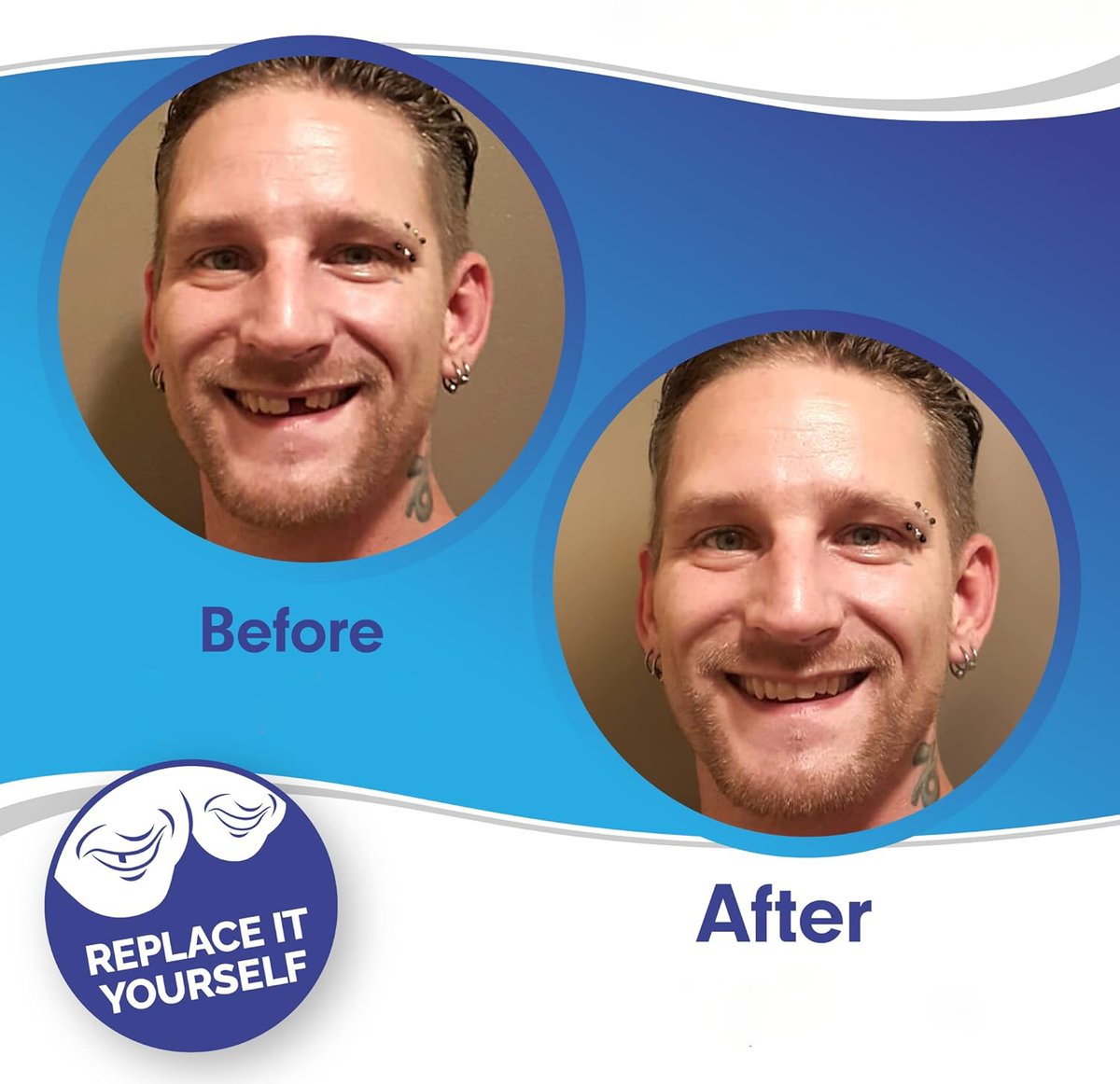 Cosmetic Tooth Covers Upper & Lower Set Instant Snap-On Dental Overlay for Natural Looking Smile Confidence Booster Reusable Teeth Caps