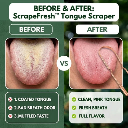 Tongue Scraper Ergonomic Double-Edged Stainless Steel