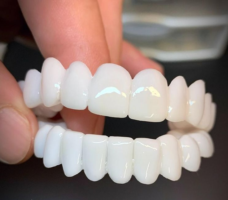 Cosmetic Tooth Cover for Missing Teeth & Gaps — Reusable Snap-On Veneers for Men & Women