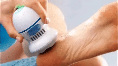 Foot Callus Remover Rechargeable Built-In Vacuum Dual Grinding Heads