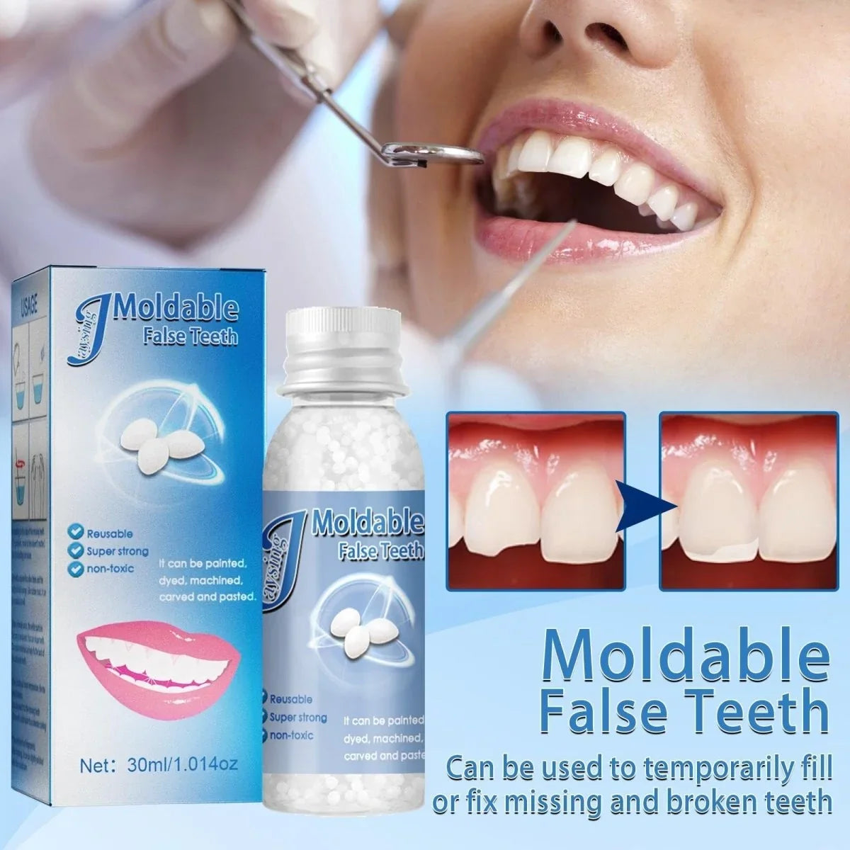 Tooth Repair Granules Boil To Mold Natural Looking Reusable
