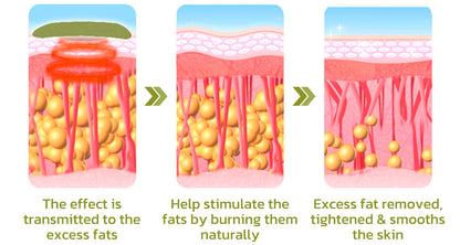 Patch for Reducing Cellulite - Natural Formula