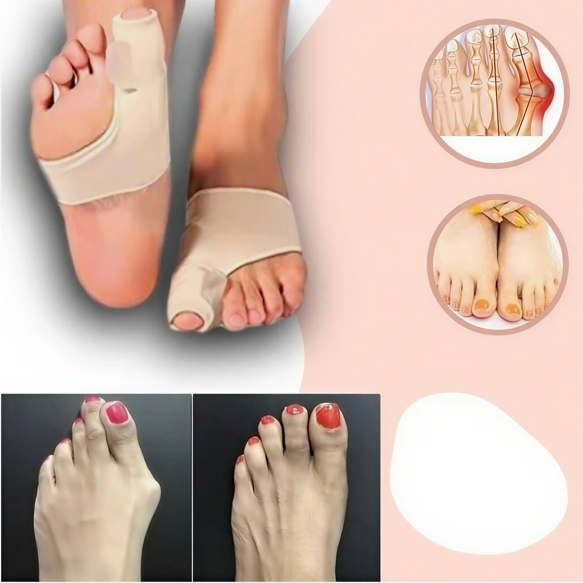 Gel Toe Spacer for Bunion Relief & Big Toe Alignment | Non-Surgical Hallux Valgus Corrector Sleeve | Soft Polymer Cushion Separator | Day