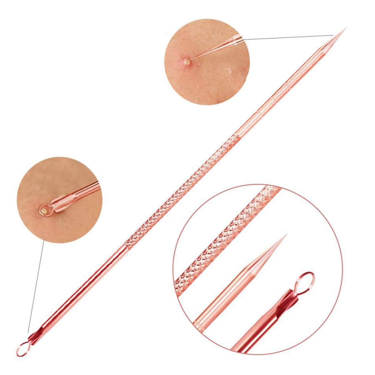 Essential Blackhead & Pimple Extractor Kit with Protective Case for Flawless Skin