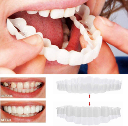 Natural Smile Veneers Upper Lower Teeth Kit - Ortekor