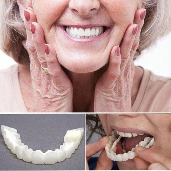 Natural Smile Veneers Upper Lower Teeth Kit