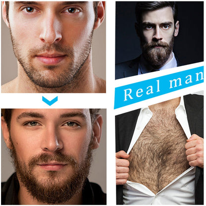 Facial Hair Growth System with Derma Roller & Natural Serum for Fuller Beard Development