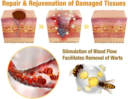 Skin Tag & Wart Removal Spray with Natural Bee Venom Extract for Blemish-Free Complexion at Home Treatment