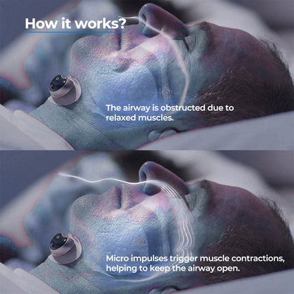 Anti Snoring Device, Anti Snore Chin Clip for Nasal Breathing, Soft Adjustable Chin Support Snoring Aid for Sleep