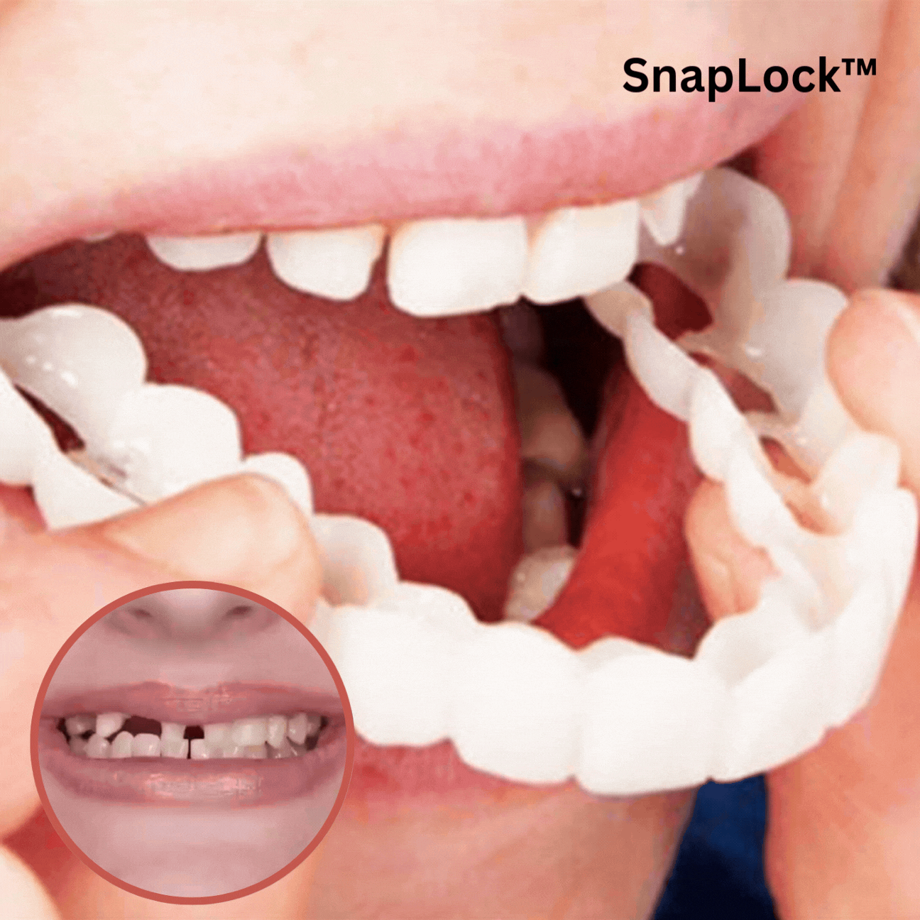Clip-On Cosmetic Tooth Veneers – Temporary Smile Cover with Heat-Moldable Fit for Natural White Appearance