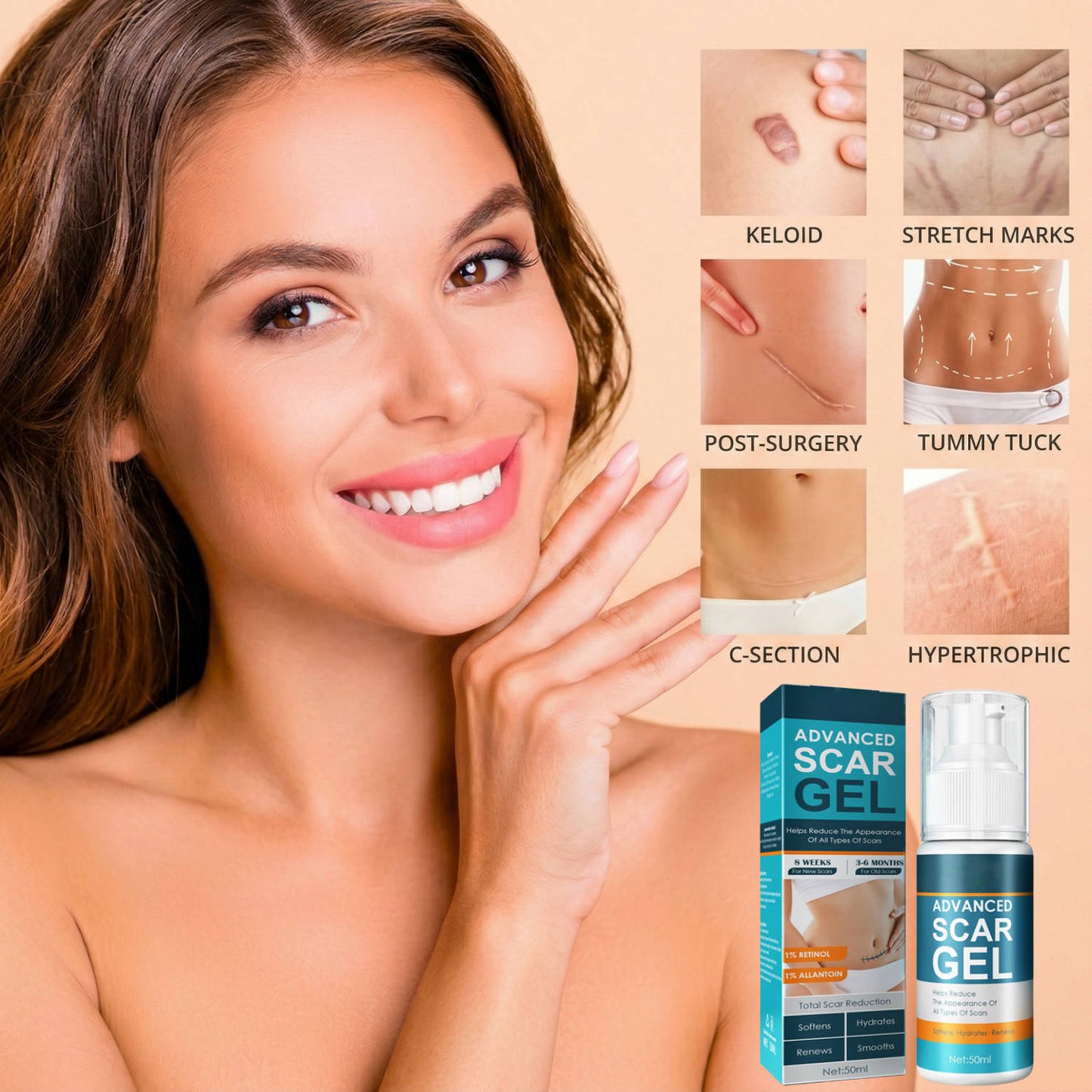 Silicone Scar Removal Cream for Fade Marks and Stretch Marks