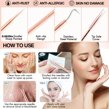 Essential Skin Care | Pimple Extractor Tool Kit with Safe Stainless Steel | Professional Blackhead Removal for Clear Complexion