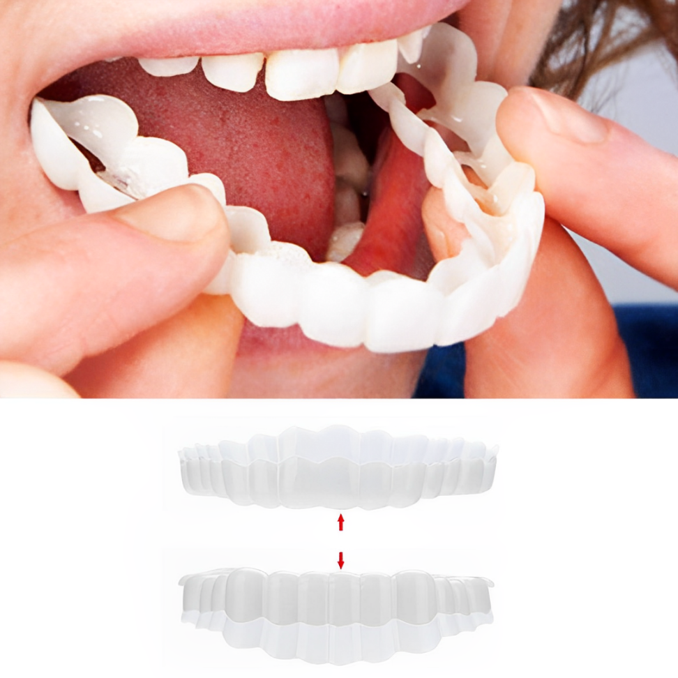 Cosmetic Tooth Covers Upper & Lower Set Instant Snap-On Dental Overlay for Natural Looking Smile Confidence Booster Reusable Teeth Caps