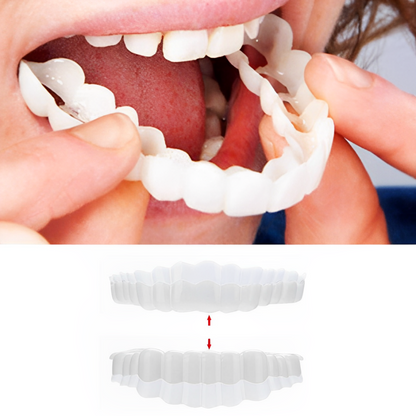 Cosmetic Tooth Covers Upper & Lower Set Instant Snap-On Dental Overlay for Natural Looking Smile Confidence Booster Reusable Teeth Caps