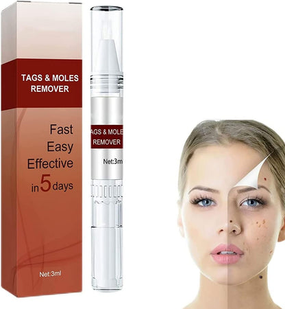 Precision Skin Tag & Wart Removal Pen with Botanical Extract Formula for At-Home Spot Treatment