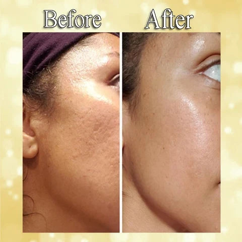 Anti-Aging Serum 24K Gold & Hyaluronic Acid