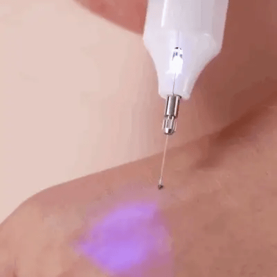 Skin Spot Removal Pen Rechargeable Plasma Painless