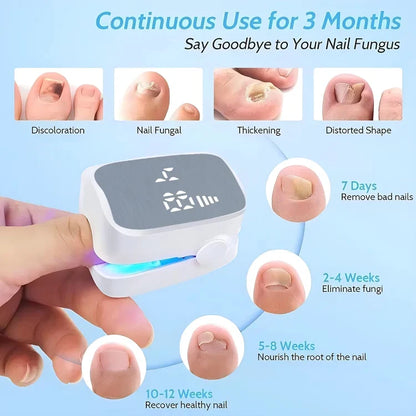Nail Fungus Treatment 7-Min Daily Antifungal Serum