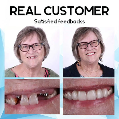 Removable Cosmetic Teeth Veneers for Adults – Instant Smile Enhancer with Silicone Liner, Reusable Snap-On Dental Cover for Natural Look