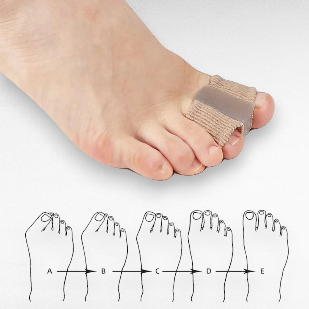 Gel Toe Spacers for Bunions, Hallux Valgus & Overlapping Toes – Soft Separator Cushions for Pain Relief & Alignment, Wearable in Shoes or