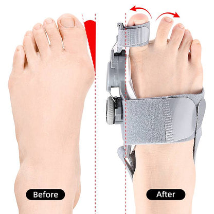 Adjustable Toe Straightener with Hinge System for Hallux Valgus Relief & Foot Alignment – Silicone Spacer for Day & Night Support