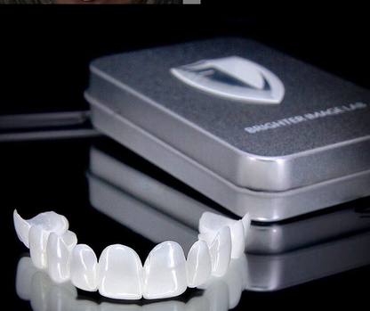 DentAlign | Snap On Teeth Veneers with Custom Fit for Natural Smile