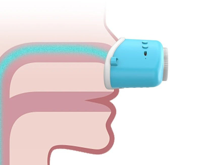 Wireless Sleep Apnea Relief Device – Rechargeable Nasal Airflow System for Snore Reduction & Better Breathing at Night for Adults