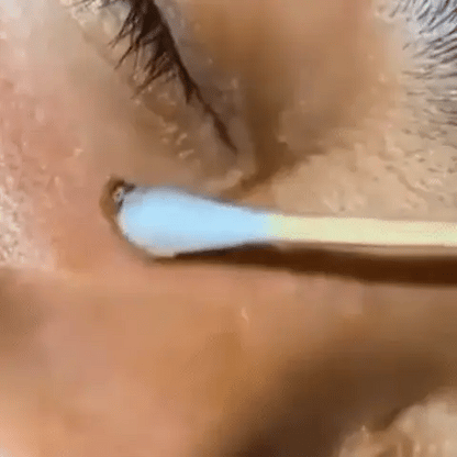 Serum Turmeric Brightening Dark Spot Correcting