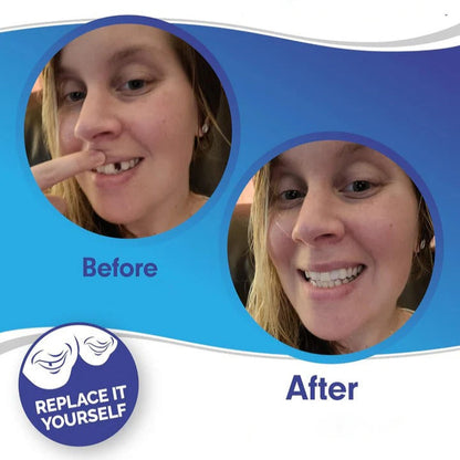 Easy Fit Clip On Smile Veneers Upper Lower Teeth