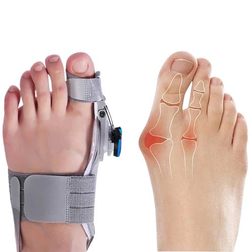 Adjustable Toe Spacer Corrector for Foot Alignment