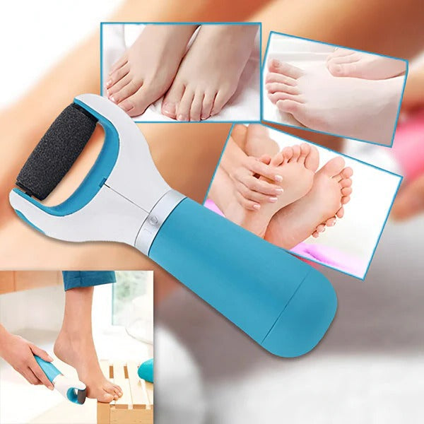Easy Foot Callus Remover with Gentle Rotating Head