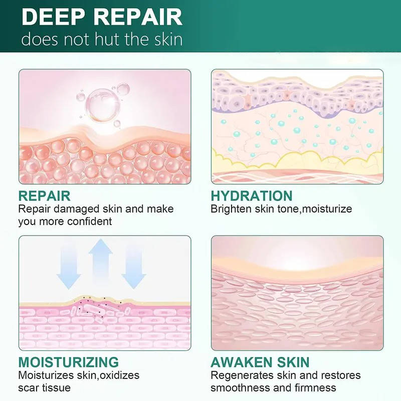 Silicone Scar Removal Cream for Fade Marks and Stretch Marks
