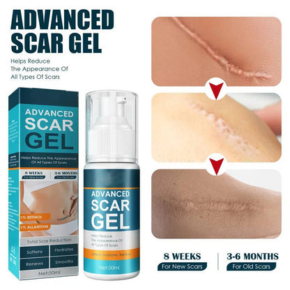Silicone Scar Removal Cream for Fade Marks and Stretch Marks
