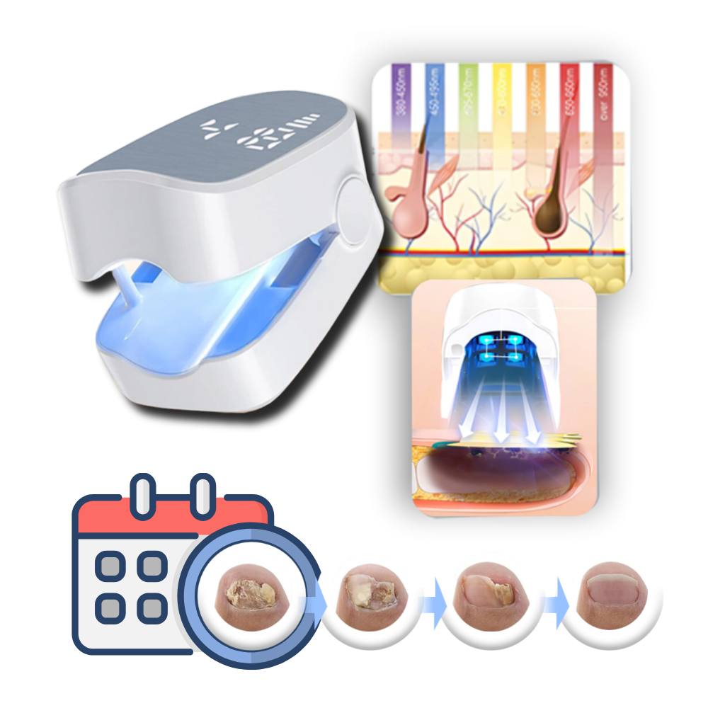 Rechargeable Light Therapy Device for Nail Care, Dual Mode Blue LED & Cold Laser Treatment, Portable 7-Minute Daily Use for Toenails &