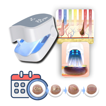Rechargeable Light Therapy Device for Nail Care, Dual Mode Blue LED & Cold Laser Treatment, Portable 7-Minute Daily Use for Toenails &