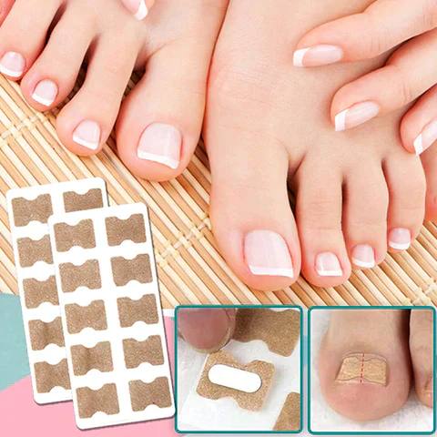Fast Nail Fix for Broken and Ingrown Nails