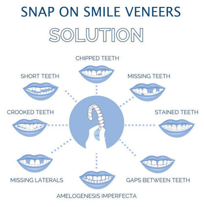 Cosmetic Tooth Covers Upper & Lower Set Instant Snap-On Dental Overlay for Natural Looking Smile Confidence Booster Reusable Teeth Caps