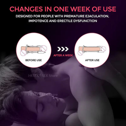 Medical-Grade Penile Extender for Natural Enhancement | Adjustable Traction System for Lasting Results