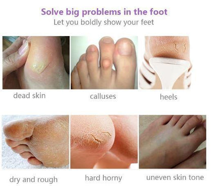 Lavender Foot Peel Treatment for Smooth Soft Feet – Removes Rough Dry Cracked Heels Dead Skin & Calluses Natural Exfoliating Booties