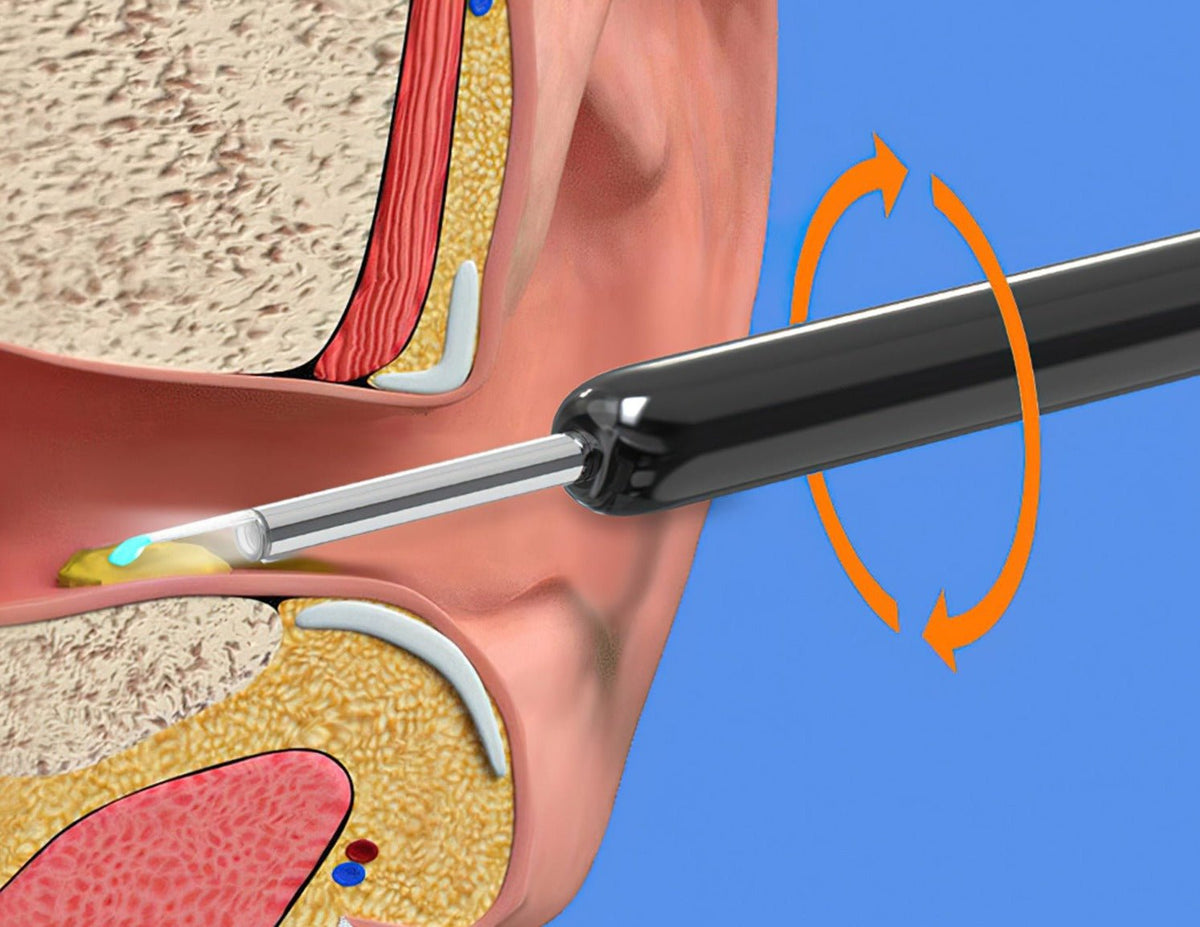 Wireless Ear Cleaning Camera with HD Scope and Silicone Tip for iPhone & Android Safe Wax Removal Tool