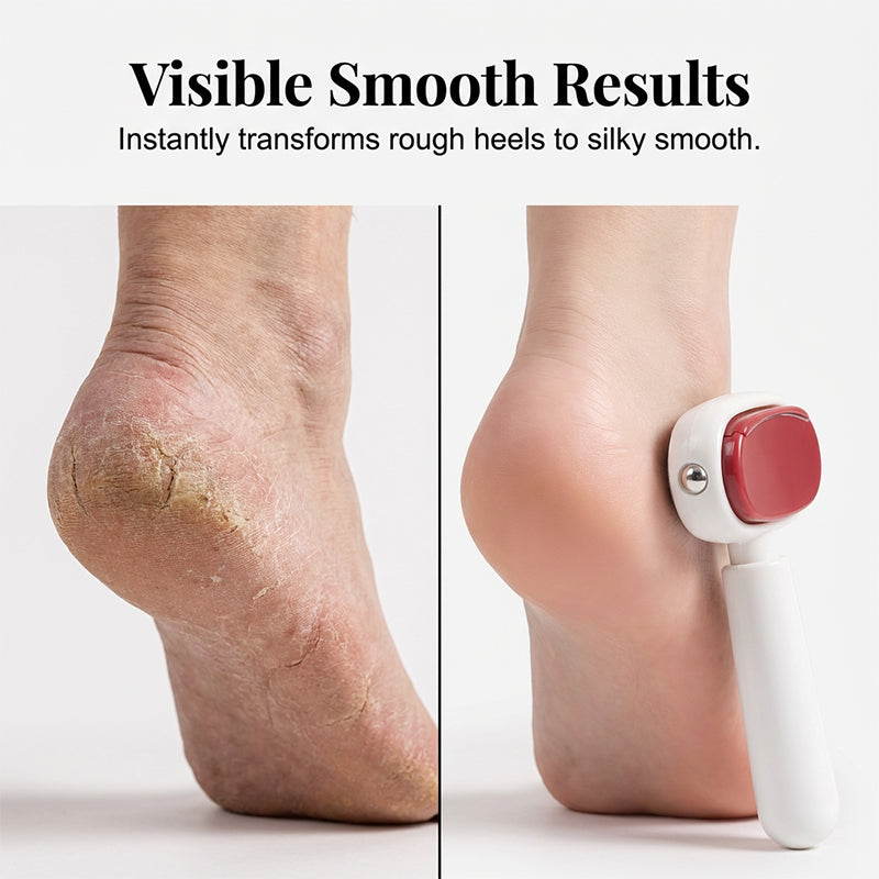 Dual-Sided Foot Callus Remover with Stainless Steel Blade for Cracked Heels, Dead Skin & Rough Feet – Ergonomic Handle Pedicure Tool